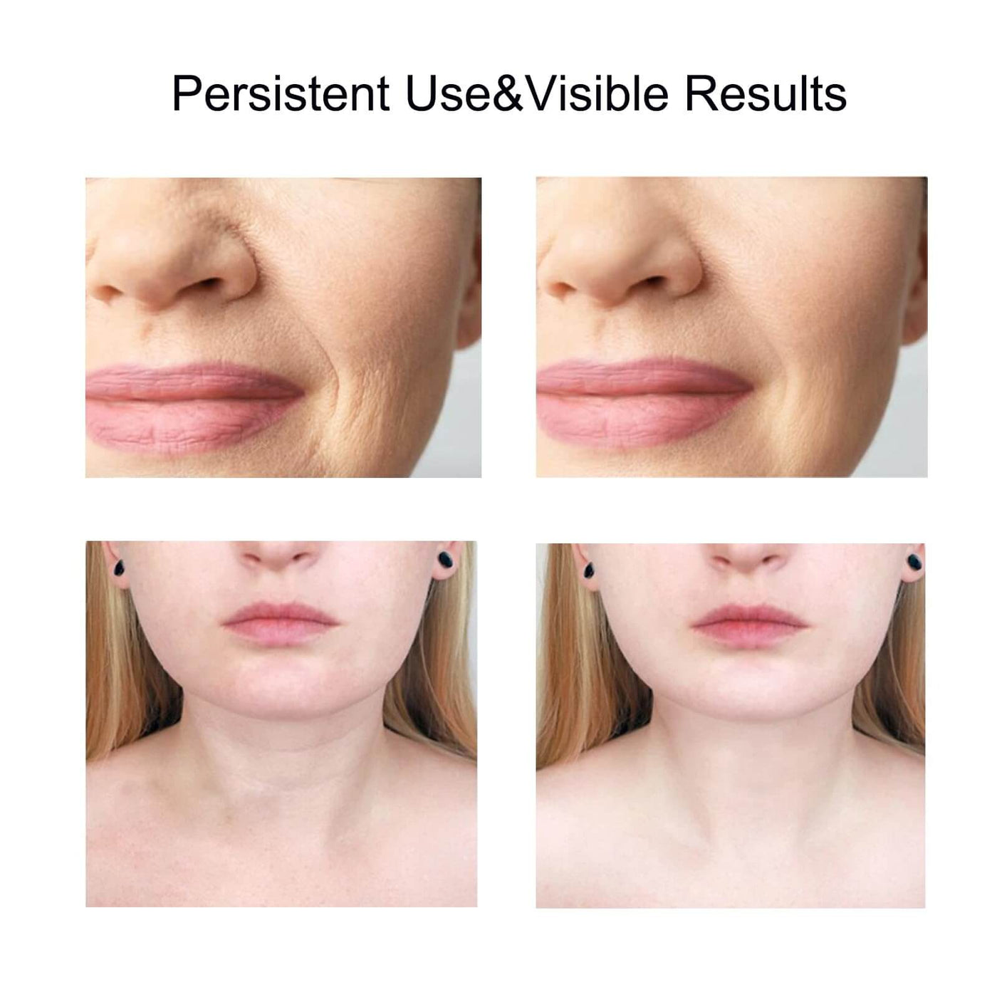 Before and after images showcasing the visible results of persistent use of a facial and neck massager.