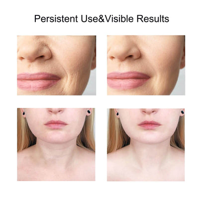 Before and after images showcasing the visible results of persistent use of a facial and neck massager.