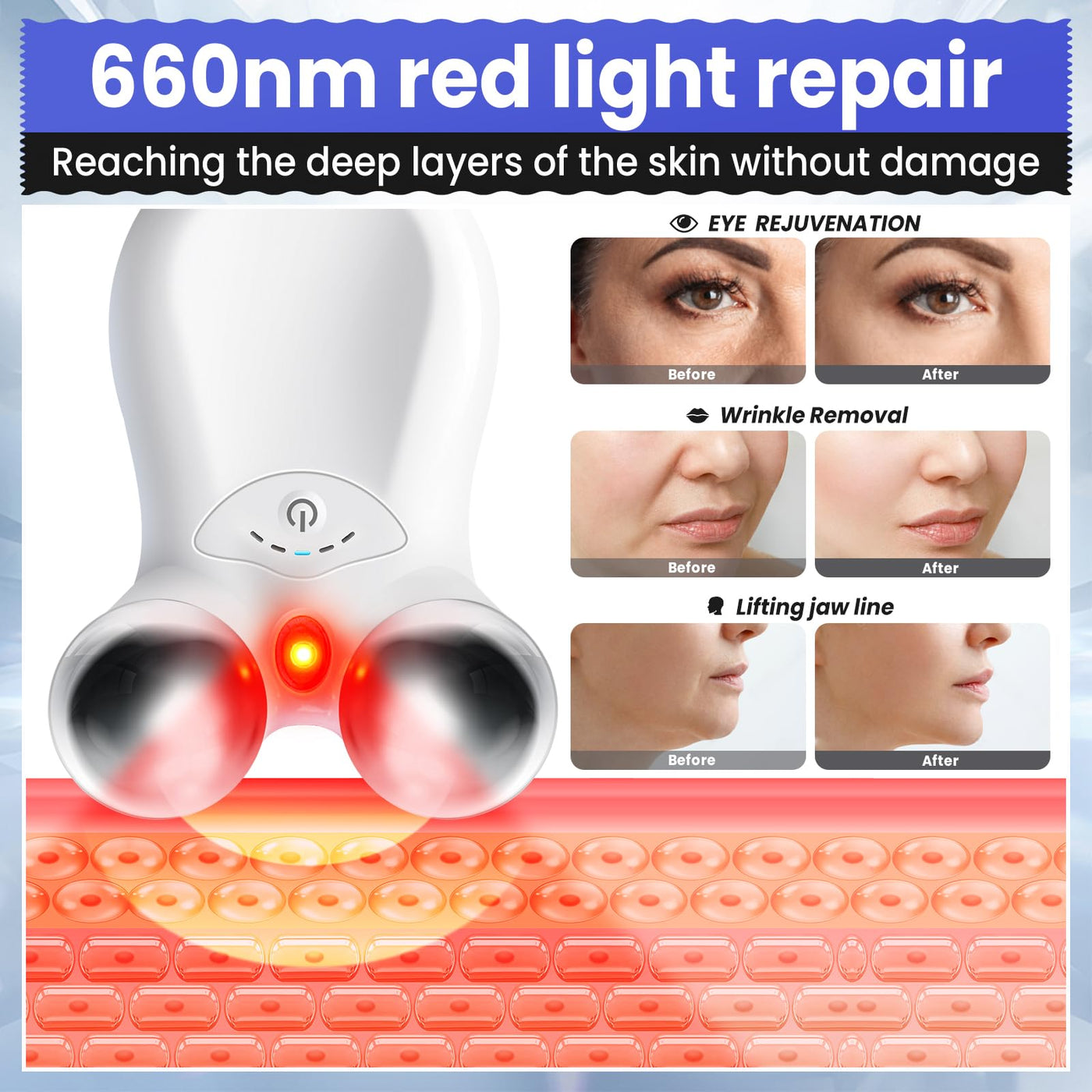 Microcurrent Facial Device